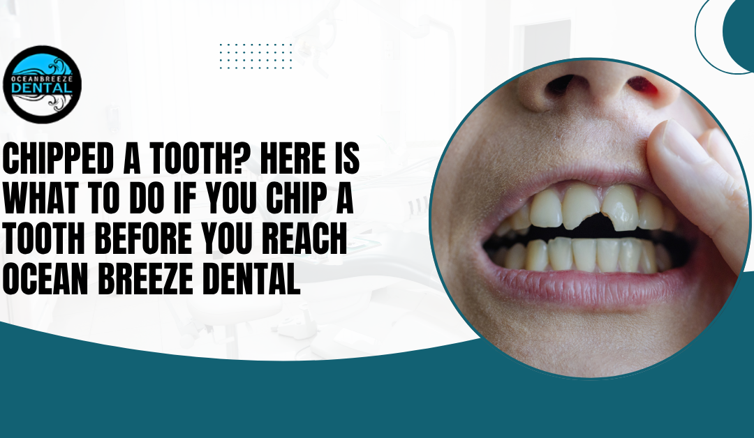 Chipped a Tooth? Here Is What to Do If You Chip a Tooth Before You Reach Ocean Breeze Dental